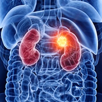 Metastatic Clear Cell RCC Subsets | Image Credit: © SciePro - stock.adobe.com