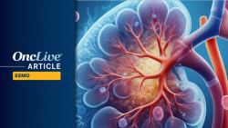 Precision Strategies and Targeted Combinations in GU Oncology: Expert Insights From ESMO 2025