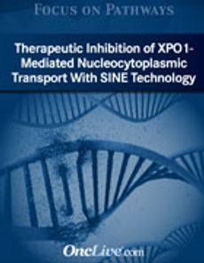Focus on Pathways: Therapeutic Inhibition of XPO1- Mediated Nucleocytoplasmic Transport With SINE Technology