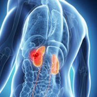 Nivolumab Plus Salvage Immunotherapy Leads to High TFS Rates in Advanced RCC | Copyrights: Adobe Stock Images