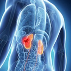 Lenvatinib Plus Pembrolizumab Improves PFS2 Outcomes in Advanced RCC