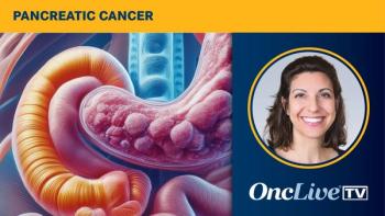 Pancreatic cancer | Image Credit: © Image by Ashling Wahner & MJH Life Sciences Using AI