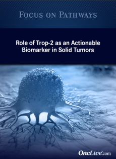 Role of Trop-2 as an Actionable Biomarker in Solid Tumors