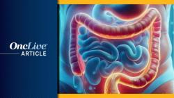 Porustobart Plus Tislelizumab Yields Promising Responses in Pretreated MSS mCRC