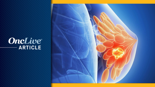 Breast Cancer | Image Credit: © Sebastian Kaulitzki - stock.adobe.com