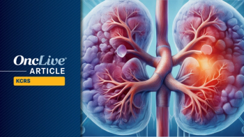 RCC | Image Credit: © Ashling Wahner & MJH Life Sciences Using AI