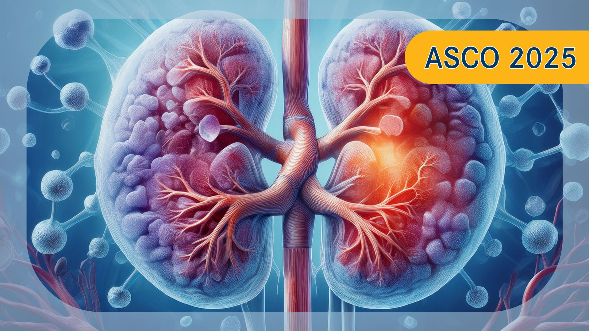 ccRCC | Image by Ashling Wahner   & MJH Life Sciences Using AI