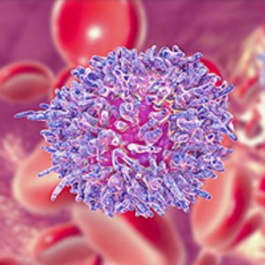 Among patients with newly diagnosed high-risk multiple myeloma, treatment with BCMA/CD19 dual-targeting FasTCAR-T Cells resulted in an overall response rate of 100%, with all treated patients evaluable for minimal residual disease showing minimal residual disease negativity to 12 months.