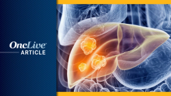 LEAP-012 Trial of Pembrolizumab/Lenvatinib/TACE to Close Following Missed OS End Point in Unresectable HCC