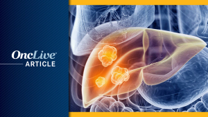 STRIDE Plus TACE and Lenvatinib in HCC: ©liver v1: Sebastian Kaulitzki - stock.adobe.com