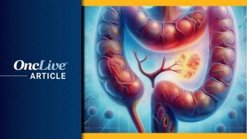 Colon Cancer | Image Credit: Ashling Wahner & MJH Life Sciences Using AI