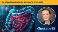 Elena Elimova, MD, discusses data from a HERIZON-GEA-01 PD-L1 subgroup analysis in HER2-positive gastroesophageal adenocarcinoma.