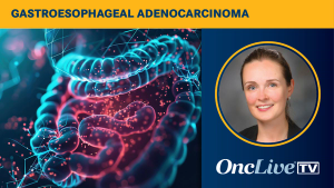 Elena Elimova, MD, discusses data from a HERIZON-GEA-01 PD-L1 subgroup analysis in HER2-positive gastroesophageal adenocarcinoma.