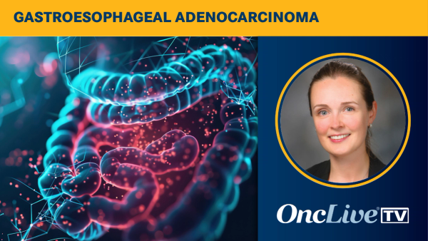 Elena Elimova, MD, discusses data from a HERIZON-GEA-01 PD-L1 subgroup analysis in HER2-positive gastroesophageal adenocarcinoma.