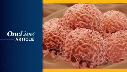 Frontline Darovasertib Plus Crizotinib Shows Clinical Efficacy in Metastatic Uveal Melanoma