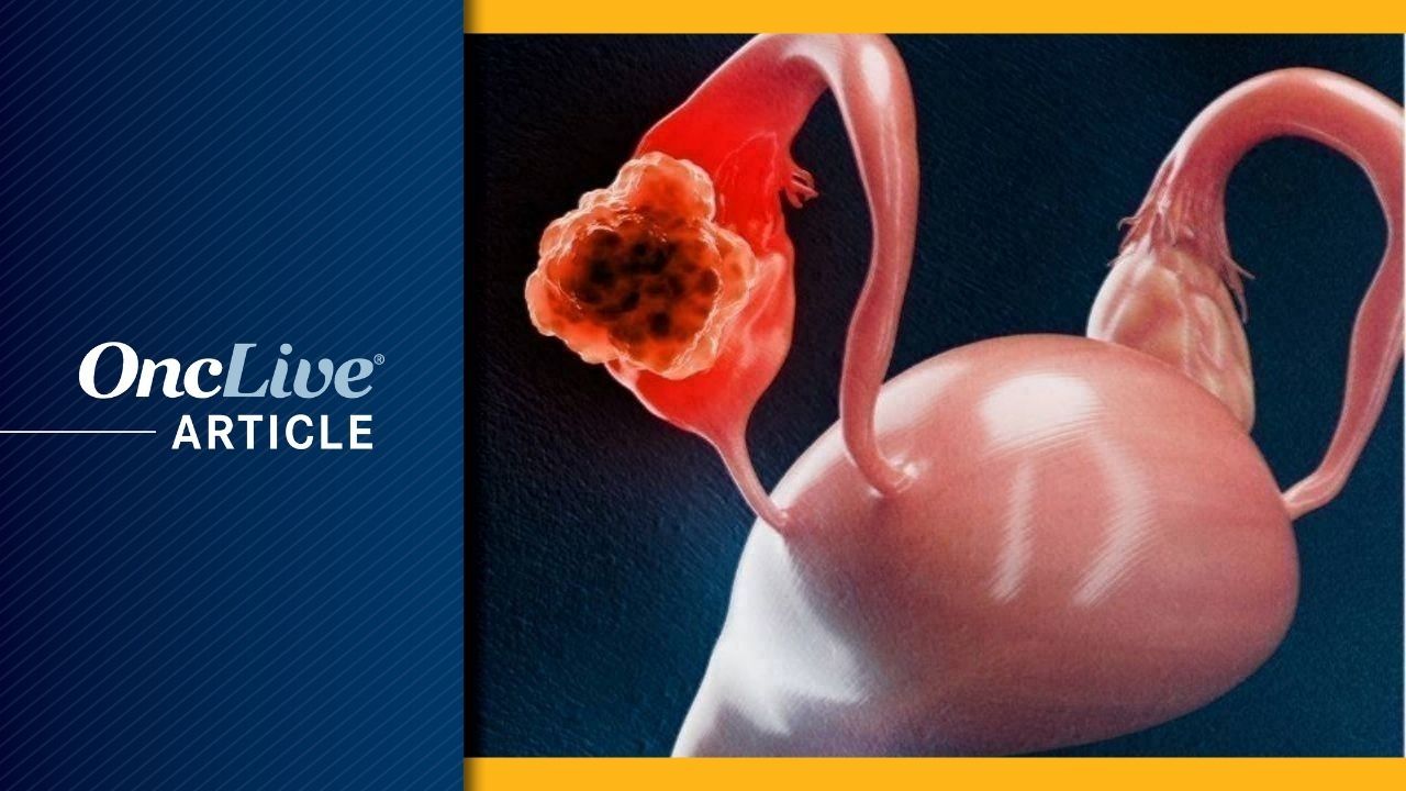 Platinum-Resistant Ovarian Cancer | Image Credit: © Tom - stock.adobe.com