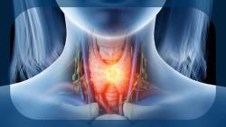 FDA Provides Guidance on Registrational Path for Ozuriftamab Vedotin in Oropharyngeal Squamous Cell Carcinoma