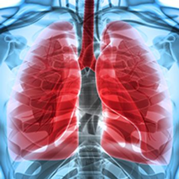 lung cancer