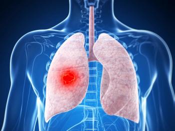 OncLive NSCLC Early Career Clinical Trial Review: ASCO 2024