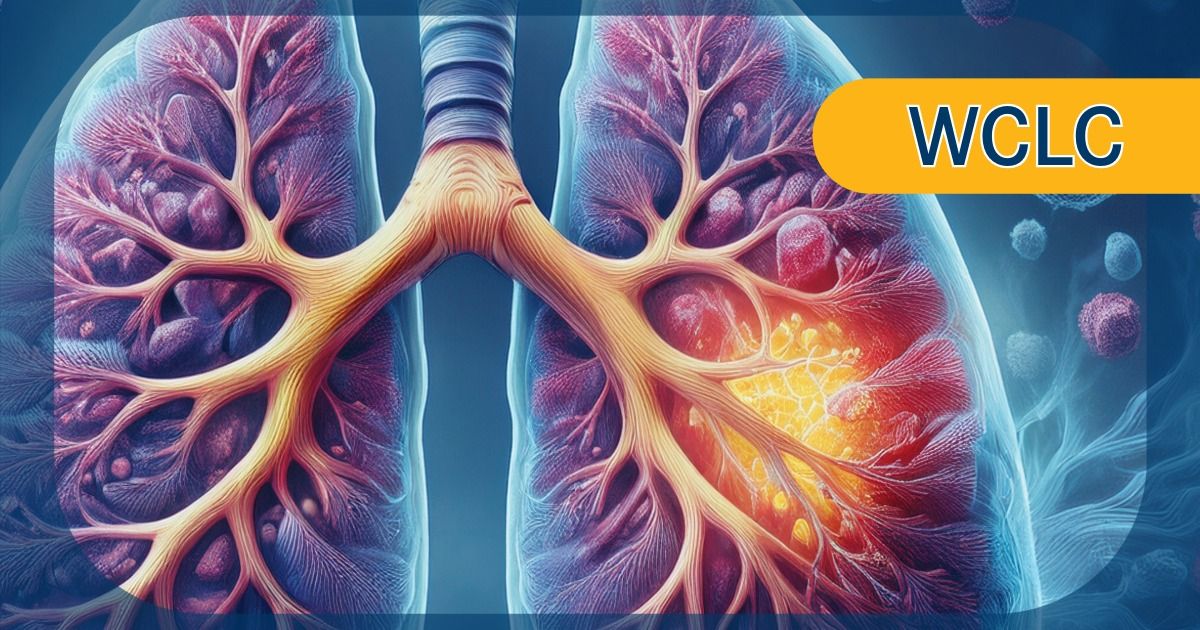 Lutetium Lu 177 dotatate in BP-NETs |  Image by Ashling Wahner & MJH Life Sciences Using AI
