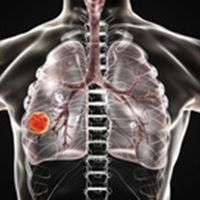 James Chih-Hsin Yang, MD, PhD, discusses the implications of the phase 3 KEYNOTE-789 trial and what directions investigators can examine in the future to help fill the unmet need for patients with TKI-resistant, EGFR-mutated metastatic non–small cell lung cancer.