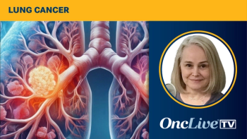 Pathology in Lung Cancer | Image Credit: © Image by Ashling Wahner & MJH Life Sciences Using AI