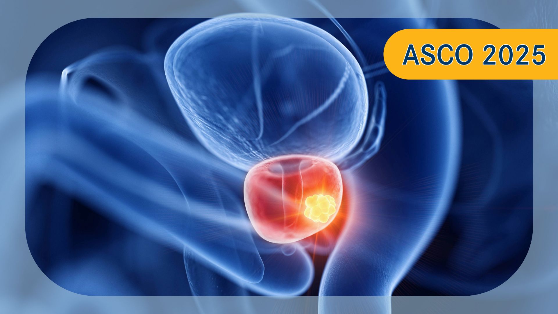 Prostate cancer | Image Credit:   Sebastian Kaulitzki © stock.adobe.com