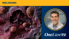 Michael A. Postow, MD, Memorial Sloan Kettering Cancer Center