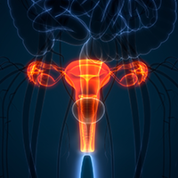 Ovarian Cancer |  Image Credit:  © magicmine - stock.adobe.com