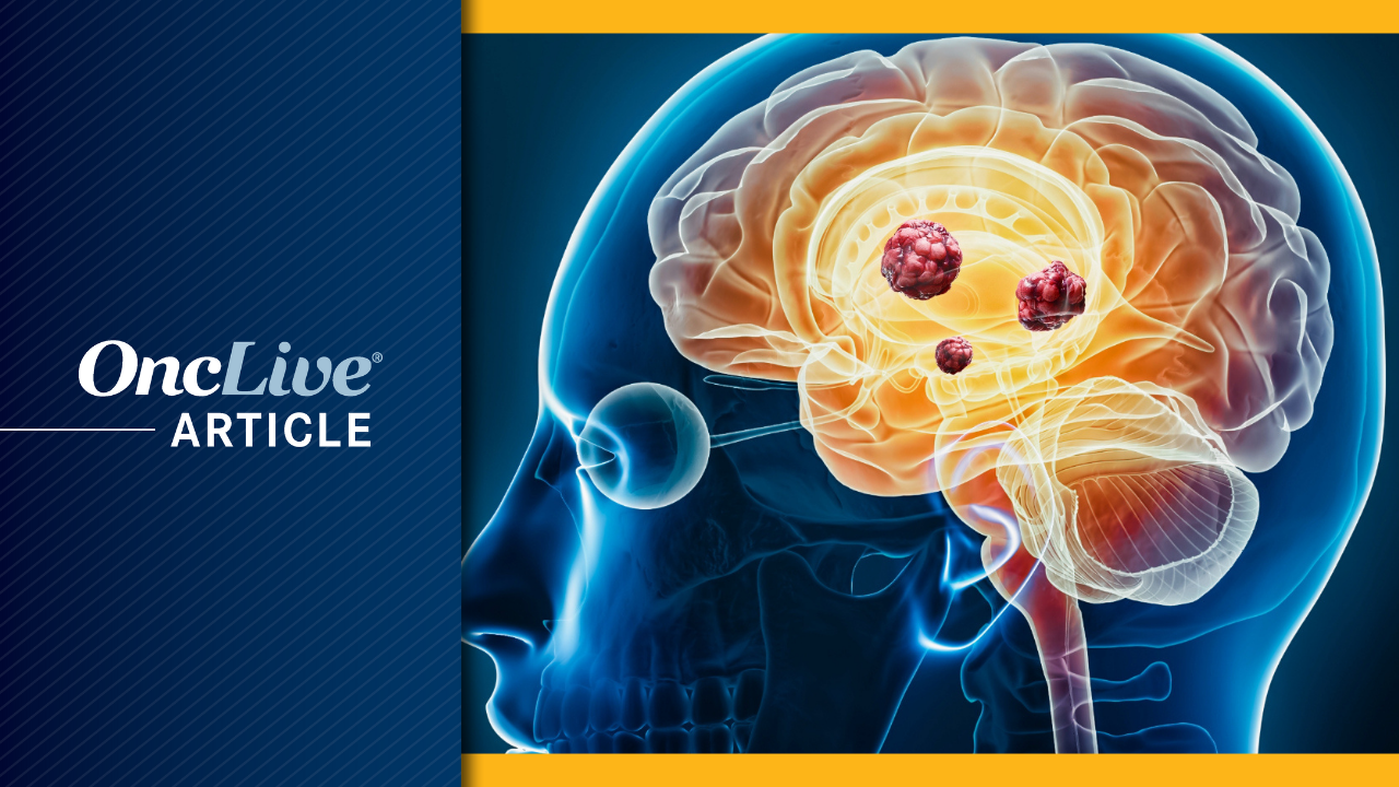 Pediatric Low-Grade Glioma | Image Credit: © Matthieu - stock.adobe.com