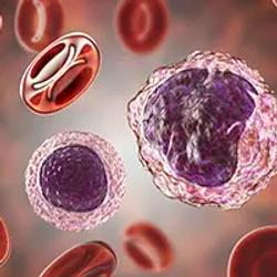 Quadruplet Regimens Stand Strong in Newly Diagnosed Multiple Myeloma