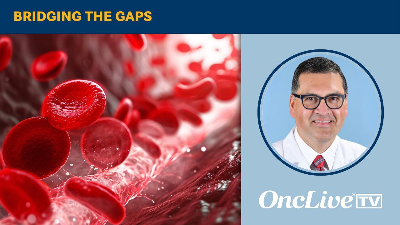 Jesús Berdeja, MD, discusses how CELMoDs such as iberdomide and mezigdomide may reshape standard-of-care treatment in multiple myeloma.