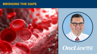 Jesús Berdeja, MD, discusses how CELMoDs such as iberdomide and mezigdomide may reshape standard-of-care treatment in multiple myeloma.