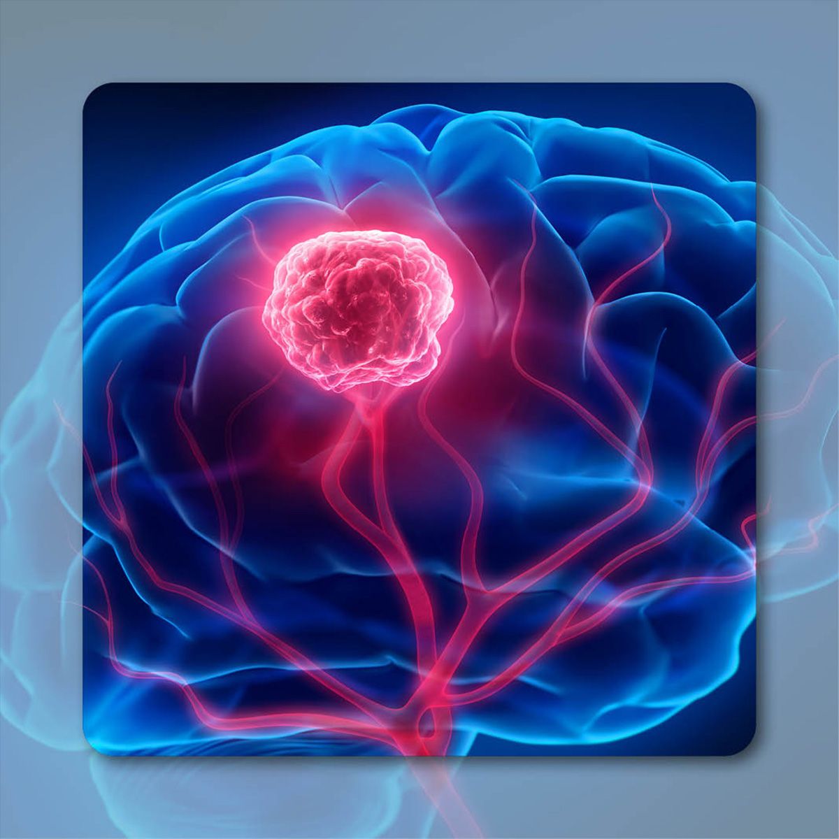 TLX101 in Recurrent High-Grade Glioma | Image Credit: © peterschreiber.media– stock.adobe.com