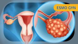 Final PICCOLO Data Underscore Mirvetuximab Soravtansine’s Efficacy in Later-Line Frα+ Platinum-Sensitive Ovarian Cancer