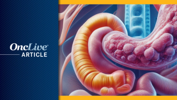 Ginisortamab plus chemotherapy in GI malignancies: Image by Ashling Wahner & MJH Life Sciences Using AI