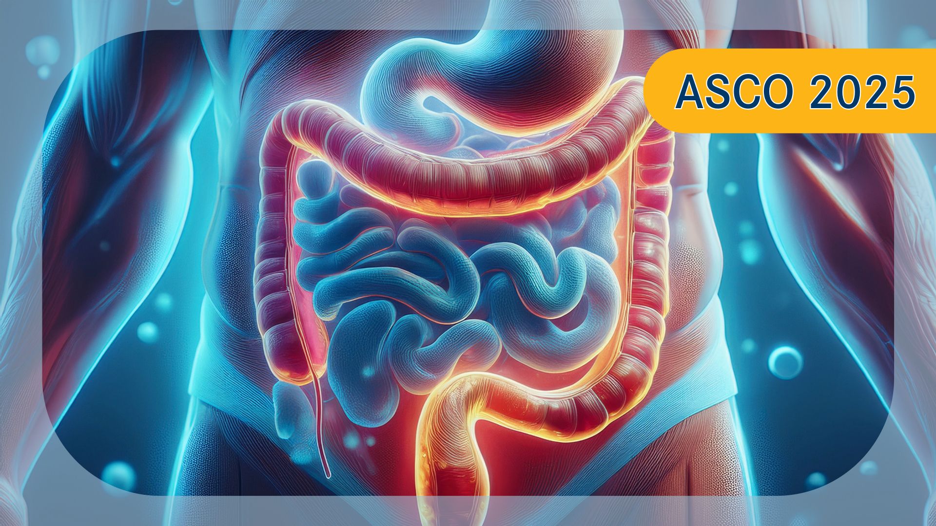 Metastatic CRC | Image credit:   Ashling Wahner & MJH Life Sciences Using AI