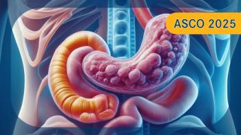 Pancreatic ductal adenocarcinoma |Image by: Ashling Wahner & MJH Life Sciences Using AI