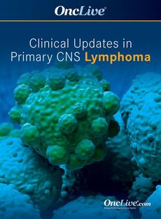 Clinical Updates in Primary CNS Lymphoma