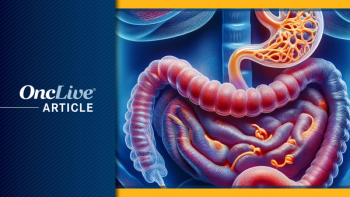 Gastrointestinal Cancer |  Image Credit: © Ashling Wahner  & MJH Life Sciences Using AI