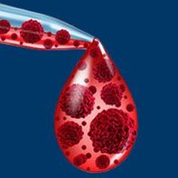 Ibrutinib Increases Risk of Select Cardiovascular AEs in Patients With Chronic Lymphocytic Leukemia