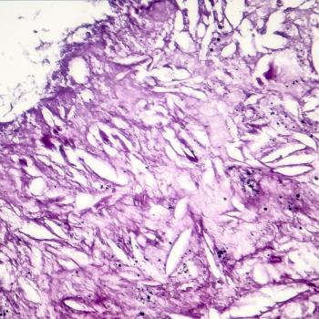 Adi Diab, MD, MD Anderson Cancer Center