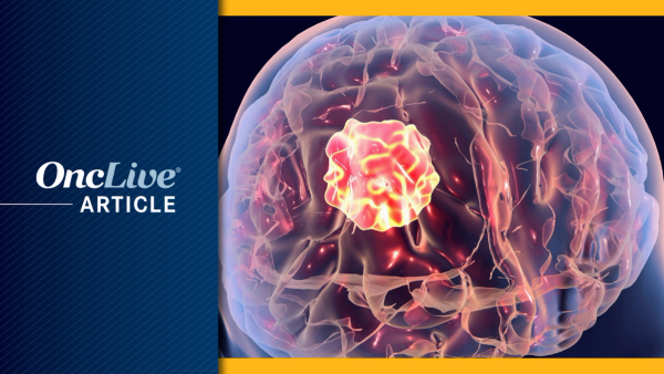 Brain cancer:  ©Dr_Microbe - stock.adobe.com
