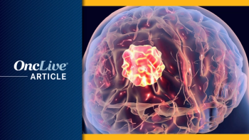 Brain cancer: ©Dr_Microbe - stock.adobe.com