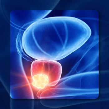 Leuprolide Mesylate in Advanced Prostate Cancer | Image Credit: © Sebastian Kaulitzki - stock.adobe.com