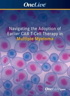 Navigating the Adoption of Earlier CAR T-Cell Therapy in Multiple Myeloma