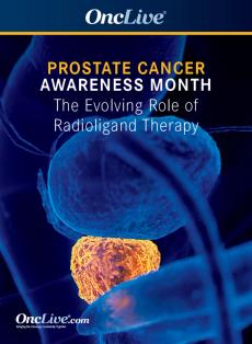 Experts discuss the evolving role of radioligand therapy during Prostate Cancer Awareness Month.