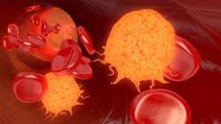 Driving Outcomes in CLL: Treatment Sequencing Strategies