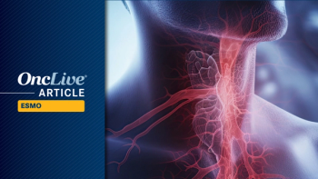 Recurrent/Metastatic HNSCC | Image Credit: © Creative Station - stock.adobe.com