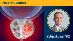 Dr Smith on the Role of Radioligand Therapy in Prostate Cancer